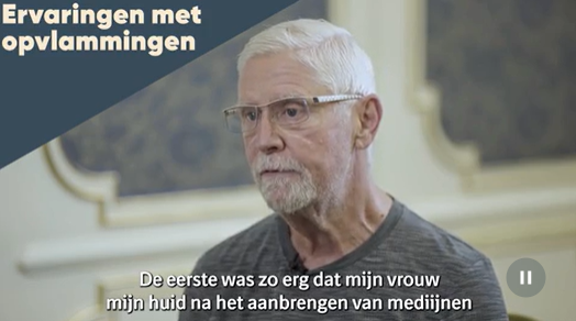 wanneer u een opvlamming krijgt