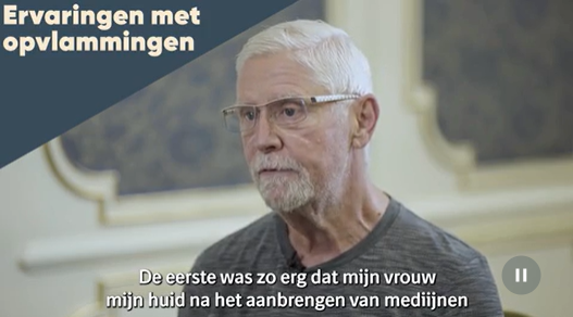 wanneer u een opvlamming krijgt